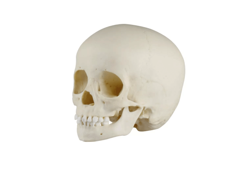 Kinderschädel, 3 - jährig – naturgetreuer Abguss mit seltenen anatomischen Besonderheiten - Erler - Zimmer